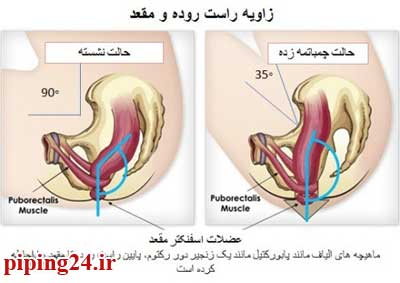 توالت ایرانی بهتر است یا فرنگی 4